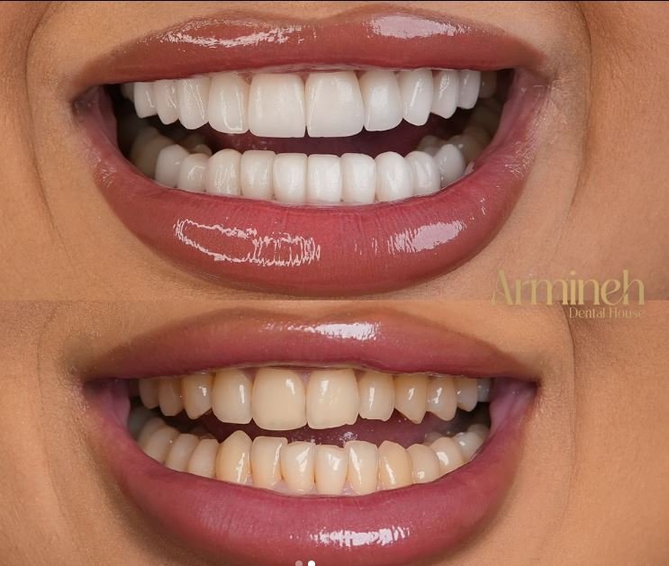 Armineh Dental Görsel 1