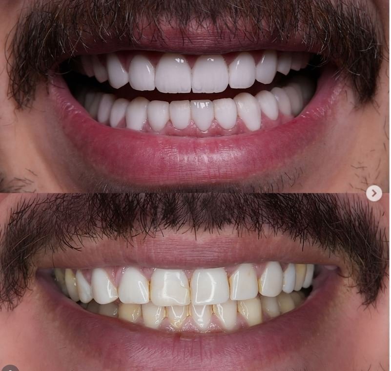Armineh Dental Görsel 3