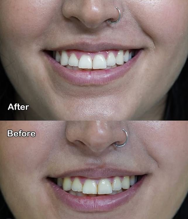 Armineh Dental Görsel 4