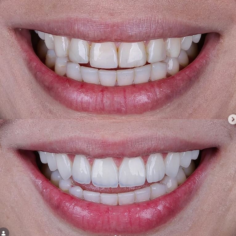 Armineh Dental Görsel 5