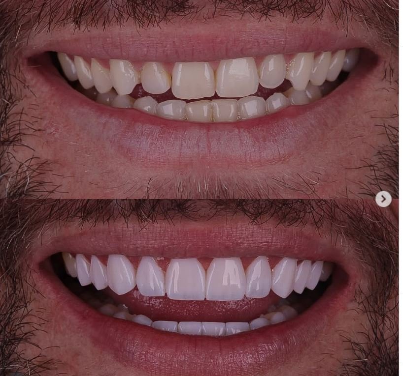 Armineh Dental Görsel 6